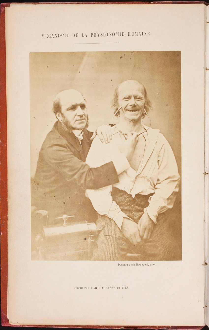 DUCHENNE DE BOULOGNE. Mécanisme de la physionomie humaine ou analyse électrophysiologique de l’expression des passions. (…)Accompagnée de 9 planches photographiées représentant 144 figures et d’un frontispice, Guillaune Benjamin Amand, Paris: 1876, Madrid, Biblioteca Museo Nacional del Prado.